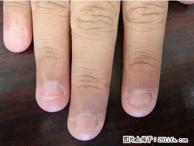 剪指甲、挖耳屎,这些日常小动作竟隐藏大危害! - 牡丹江生活资讯 - 牡丹江28生活网 mdj.28life.net